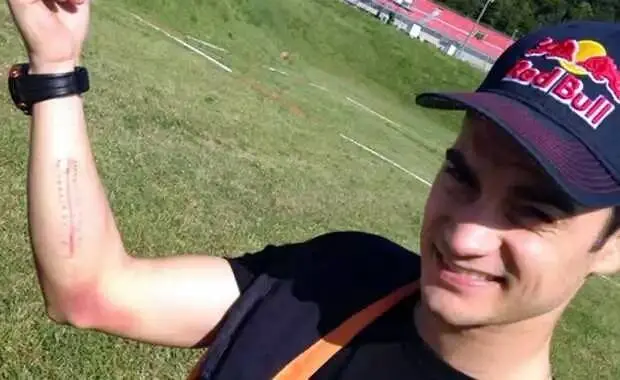 Operasi Arm Pump selama 2 jam……Dani Pedrosa hanya dibius lokal