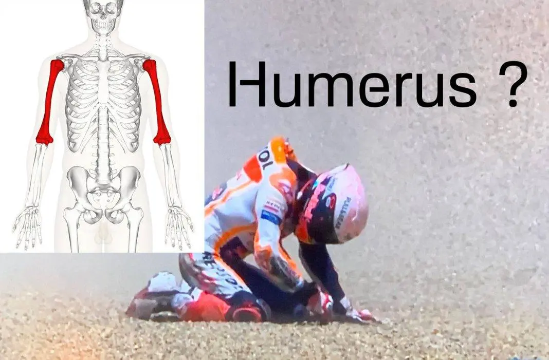 Cukup parah, Lengan kanan Marc Marquez ternyata terbentur ban, waduh